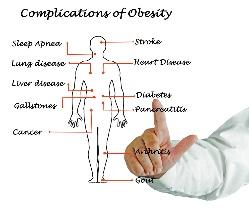 complications of obesity.jpg